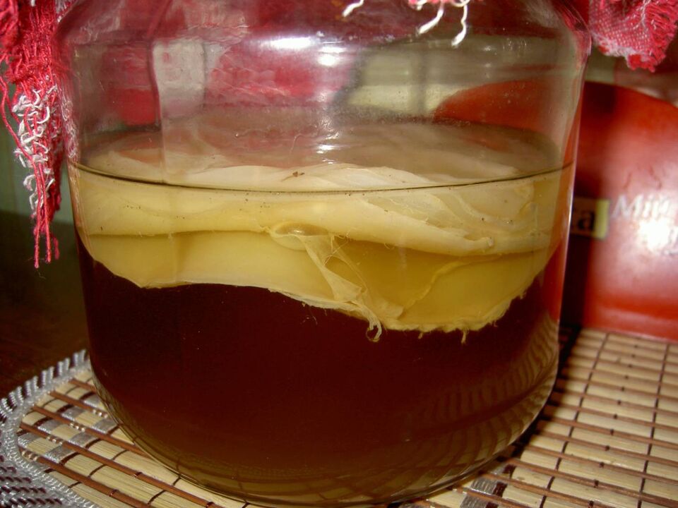 Kombucha è un rimedio efficace per il fungo del piede. 